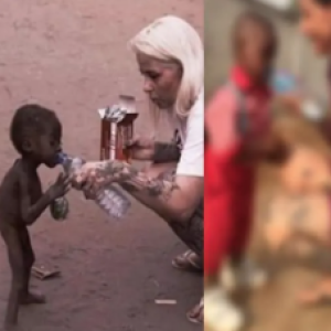 Lembra dele? Menino considerado bruxo por ser prematuro e abandonado pela família cresceu; como está hoje causa comoção