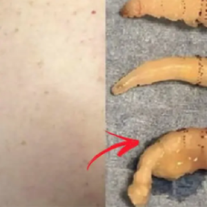 Mulher quase enlouquece de tanta coceira, vai ao médico e algo assustador é descoberto