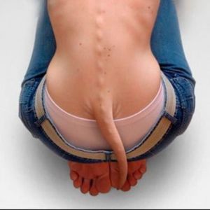 Humanos com caudas, galinhas com dentes, conheça o atavismo