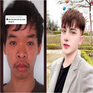 Jovem passa por transformação em cirurgia plástica depois de não conseguir encontrar emprego devido a sua aparência