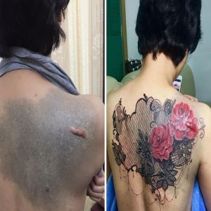 Cicatrizes viram arte com essas tatuagens #2