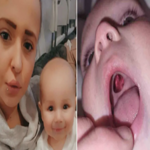 Pais encontram buraco na boca de bebê e saem correndo para hospital e o que descobrem e constrangedor