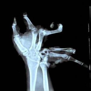 Imagens macabras e suas histórias - Parte 16