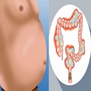  Gases intestinais - 5 formas eficazes para eliminá-los