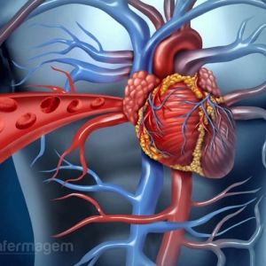 Tratamento para insuficiência cardíaca congestiva