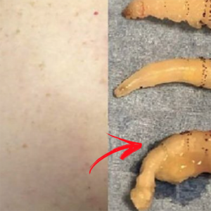 Mulher quase enlouquece de tanta coceira, vai ao médico e algo assustador é descoberto