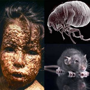 As maiores pandemias da história causadas por doenças mortais