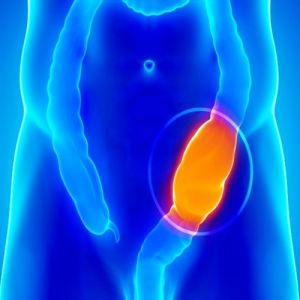 Saiba mais sobre o megacólon congênito, adquirido e tóxico