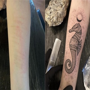 Tatuador cria projeto para ressignificar cicatrizes de automutilação