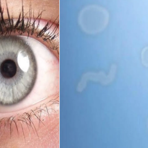 O que são aquelas pequenas manchas e pontos brancos que flutuam em sua visão?