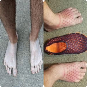 15 fotos de pessoas que levaram o bronzeamento longe demais