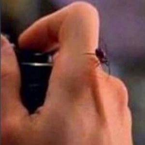 O que acontece se você for picado por uma aranha