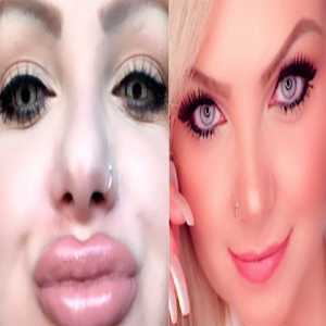 Lembra dela? Mulher Pera surge irreconhecível e revela arrependimento após procedimento estético