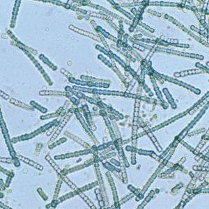 Como o DNA pode ser usado para identificar microrganismos?