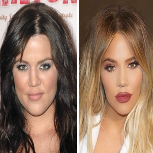 Como eram estas celebridades antes de se submeterem a tratamentos estéticos