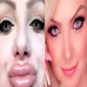 Lembra dela? Mulher Pera surge irreconhecível e revela arrependimento após procedimento estético