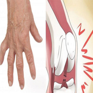 Você tem o costume de estalar os dedos? Veja porque você deve parar imediatamente de fazer isso