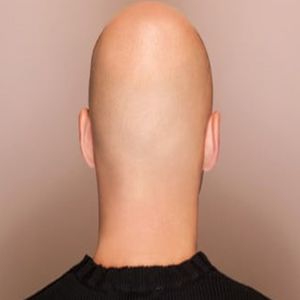 Mulher abandona seu próprio casamento depois de descobrir que o noivo é careca