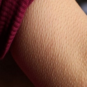  Bolinhas no corpo - principais causas e o que fazer para eliminá-las