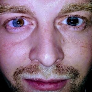 Veja 20 humanos que nasceram com diferenças genéticas interessantes #2