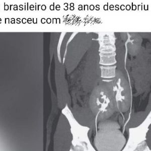 O brasileiro já nasce com doutorado em finanças