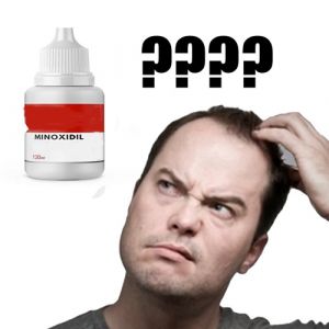 Tratamento de queda de cabelos - Efeitos colaterais do minoxidil 