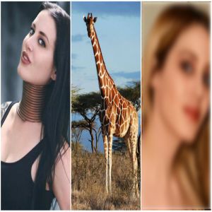 Lembra da Mulher Girafa? 5 anos depois ela tirou os anéis de metal do pescoço e chocou a internet