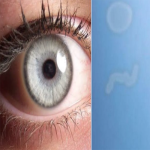 O que são aquelas pequenas manchas e pontos brancos que flutuam em sua visão?