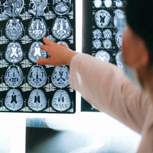6 vezes em que a inteligência artificial foi essencial na radiologia