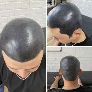 Os piores cortes de cabelo que você vai ver