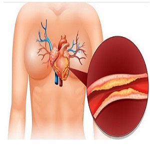  11 Dicas para baixar o colesterol ruim