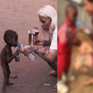 Lembra dele? Menino considerado bruxo por ser prematuro e abandonado pela família cresceu; como está hoje causa comoção