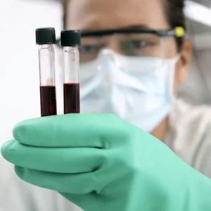 Gasometria arterial: o que é, para que serve e valores de referência