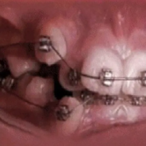 10 Gifs que mostram como as coisas realmente acontecem