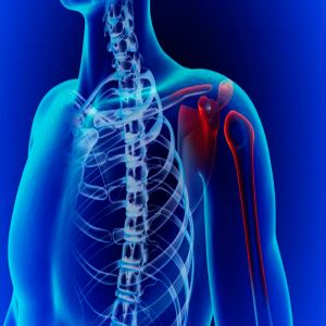 Dicas para evitar lesões no seu ombro