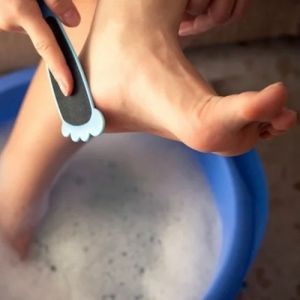 Como tratar os pés e calcanhares rachados