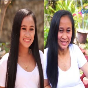 Condição rara faz com que uma garota de 16 anos pareça uma avó